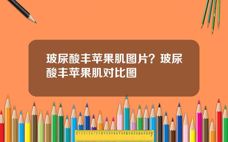 玻尿酸丰苹果肌图片？玻尿酸丰苹果肌对比图