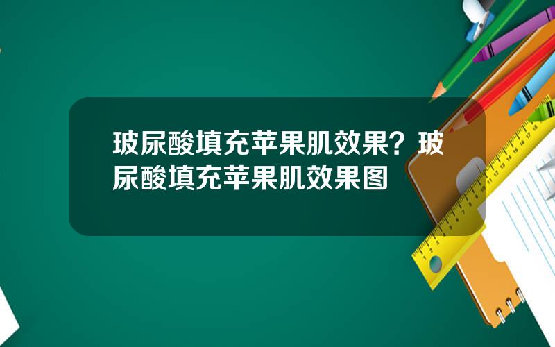 玻尿酸填充苹果肌效果？玻尿酸填充苹果肌效果图