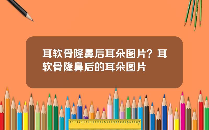 耳软骨隆鼻后耳朵图片？耳软骨隆鼻后的耳朵图片